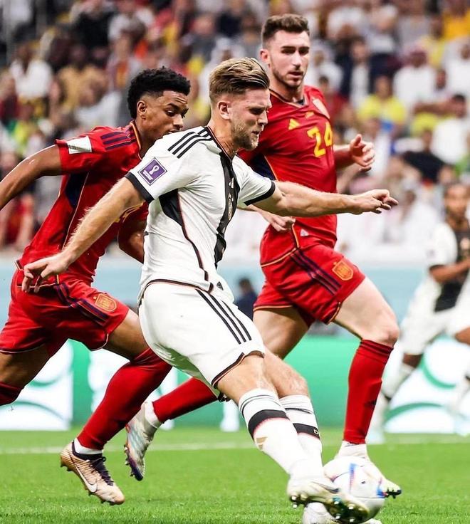 1个退赛引爆两极骂战！郑钦文伤退全运，是惜命还是失责？（郑钦文全运会因伤退赛引发两极争议：是理性自保还是失责？）