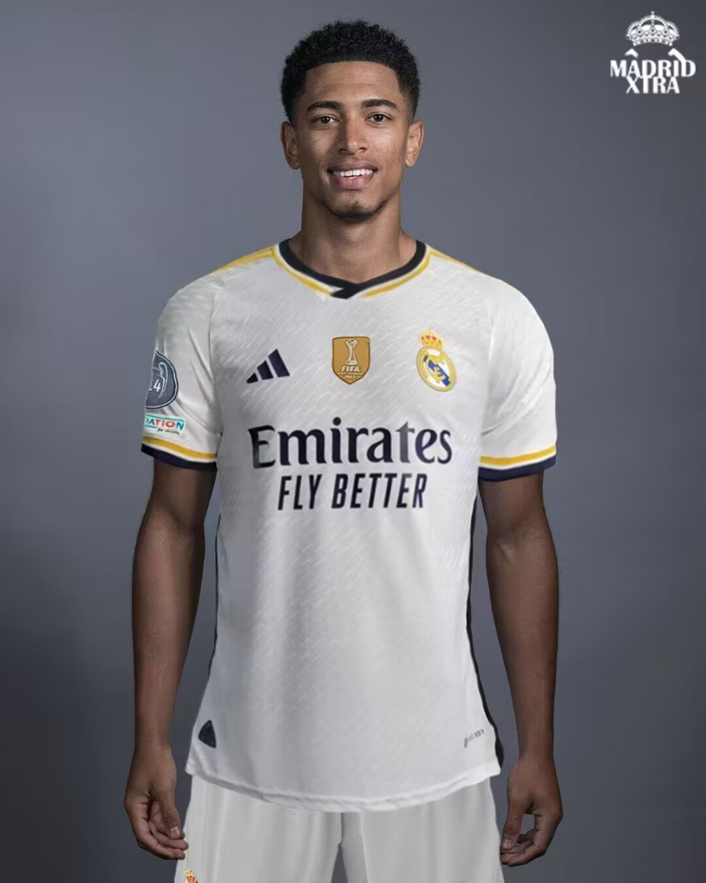 预计伤缺1个月，奥尔莫：小小的挫折只会让我更加强大（或缺阵一个月，奥尔莫：这点挫折只会让我更强）